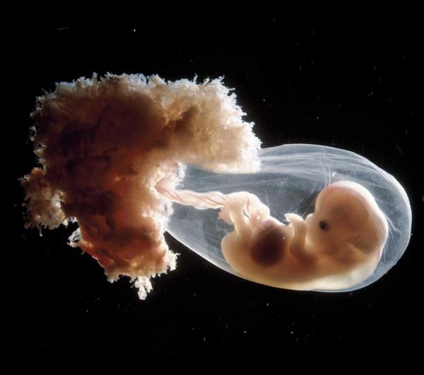 Cilvēka embrijs piektās, sestās attīstības nedēļas laikā.
