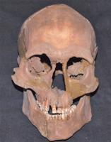 20–25 gadus veca vīrieša galvaskauss. Zvejnieku 305. apbedījums, 6870 g. p. m. ē.