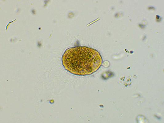 Eikariotiska infuzorija Nassula spp. ar apēstām zaļaļģēm un cianobaktērijām. Mikroskopa attēls.