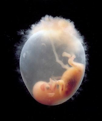 Cilvēka embrijs desmitajā attīstības nedēļā.