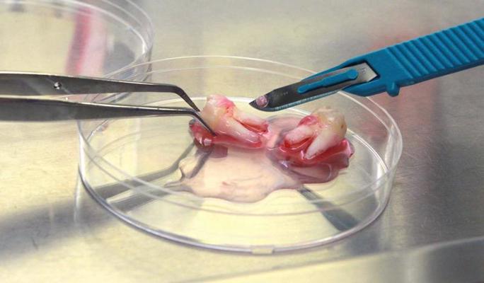 Bostonas Universitātes Medicīnas skolas (Boston University School of Medicine) doktorante Meja Alhabiba (Mey Alhabib) izņem audu paraugus no cilvēka zobiem, lai atdalītu cilmes šūnas. ASV, 17.11.2010.
