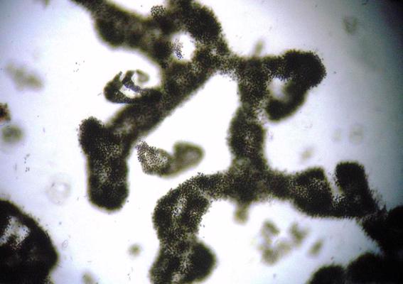 Zilaļģes (Microcystis aeruginosa) caurejošās gaismas mikroskopā.