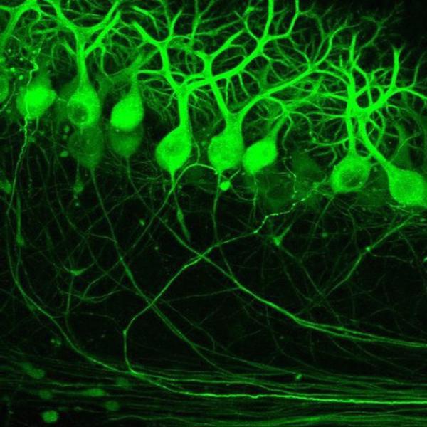 Fluorescences mikroskopijas attēls, kas iegūts, izmantojot divu fotonu absorbcijas mikroskopijas metodi, un kas atspoguļo Purkinē neironus peles smadzenīšu garozā.