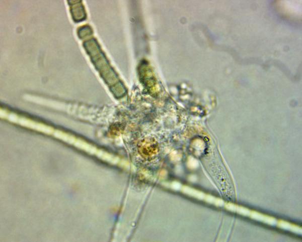 Saldūdenī brīvi peldoša amēba. Mikroskopa attēls.
