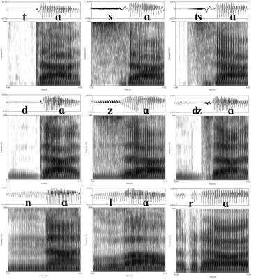 Dažu līdzskaņu oscilogrammas jeb skaņas viļņa vizualizācijas (attēlu augšējā daļa) un dinamiskās spektrogrammas (attēlu apakšējā daļa).