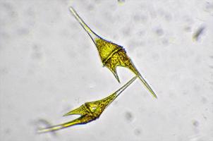 Dinofītaļģes (Ceratium hirundinella) mikroskopā, tās sastopamas lielākoties tīros ezeros.